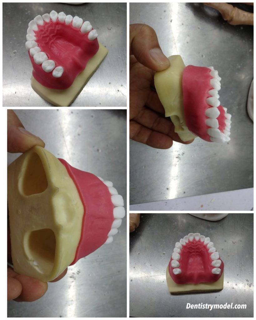 Orthodontic Practice Typodont Alexa Dental Studio